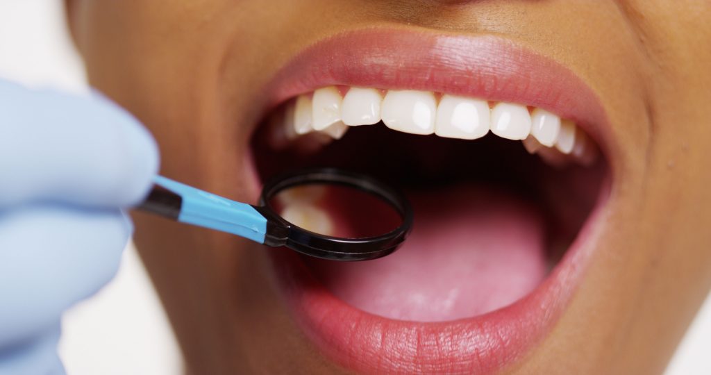 Why visit the dentist, even if you don’t feel tooth or gum pain?