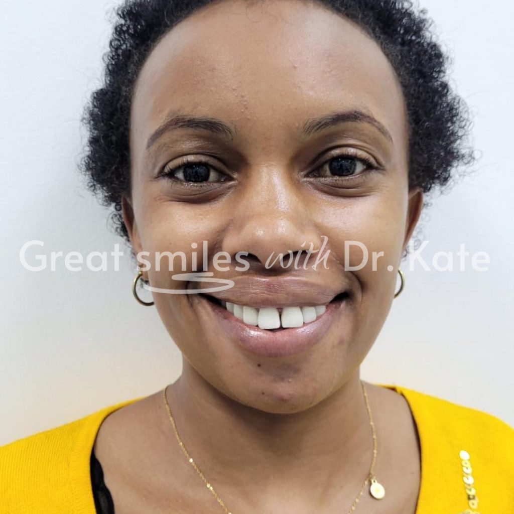 cosmetic dental treatment in nairobi