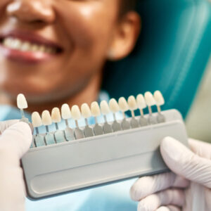 Dental veneers and dental crowns