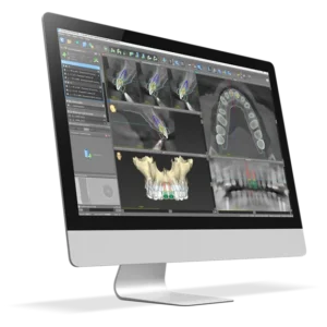 AI-powered dental implant planning in Kenya