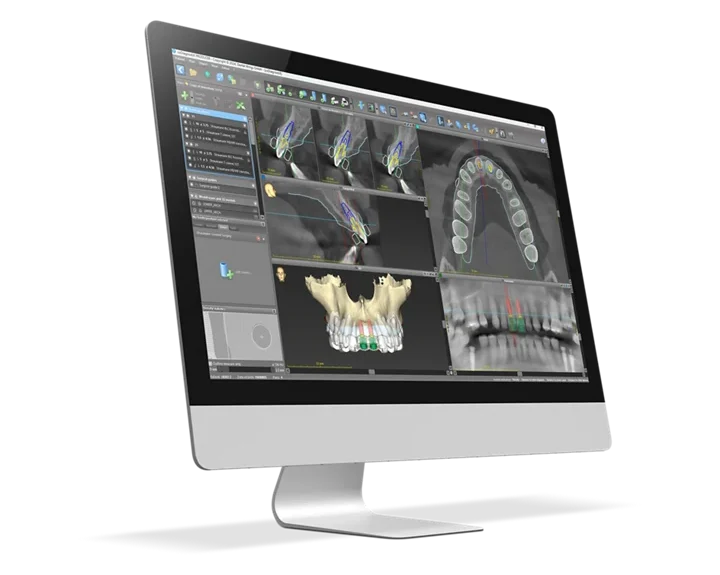AI-powered dental implant planning in Kenya