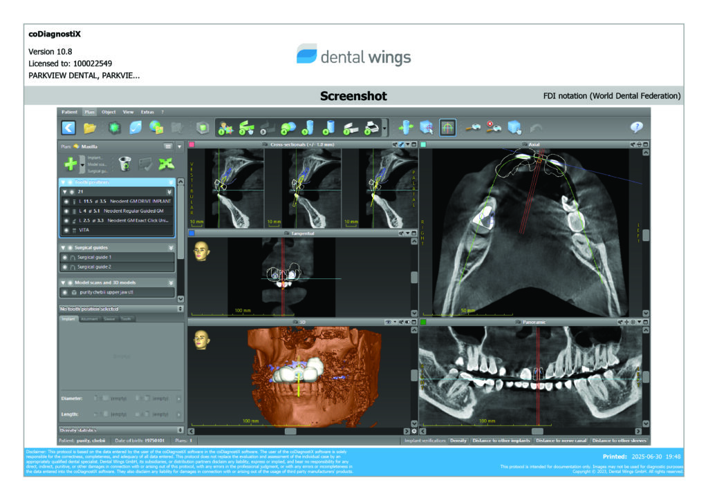 AI-powered dental implant planning