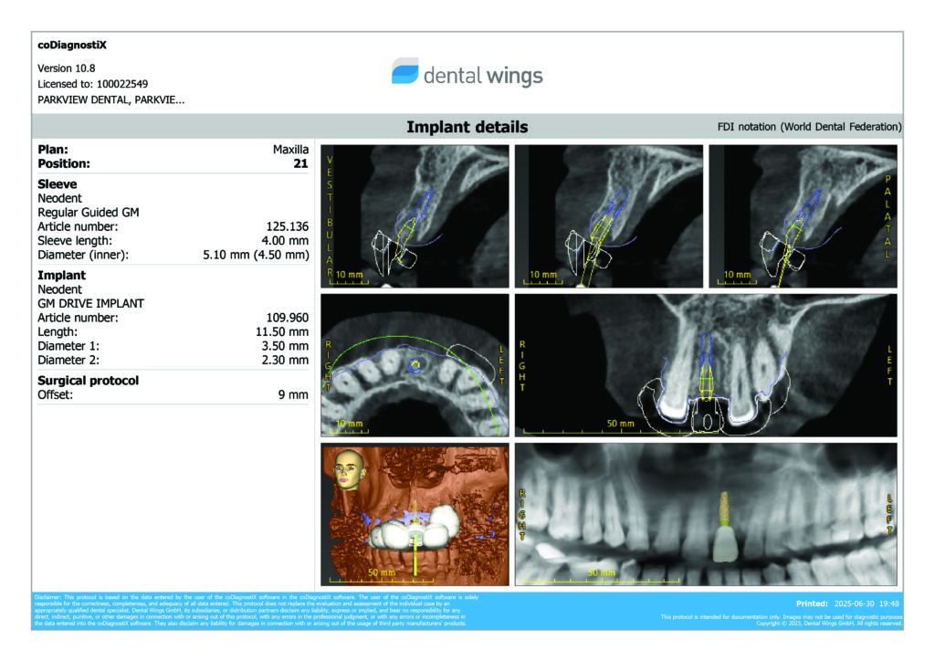 AI-powered dental implant planning