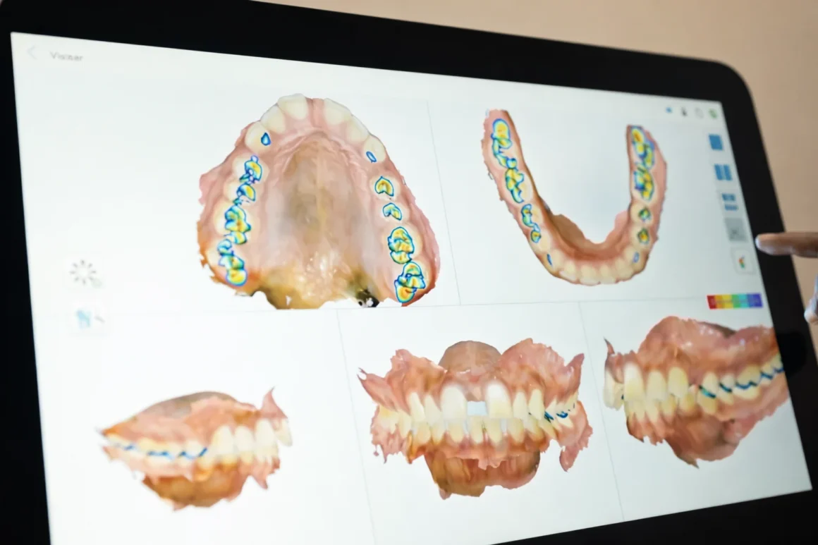 iTero Lumina itero Lumina Scanner