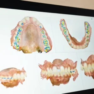 iTero Lumina itero Lumina Scanner