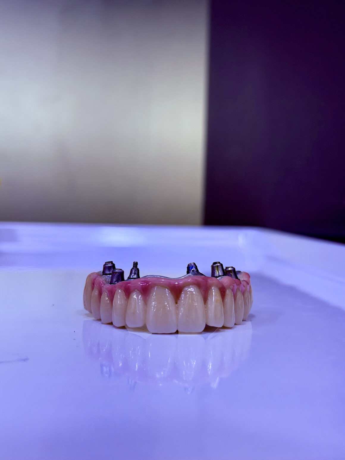 All On 6 Dental Implants