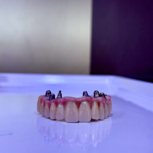 All In 6 Implants All On 6 Dental Implants